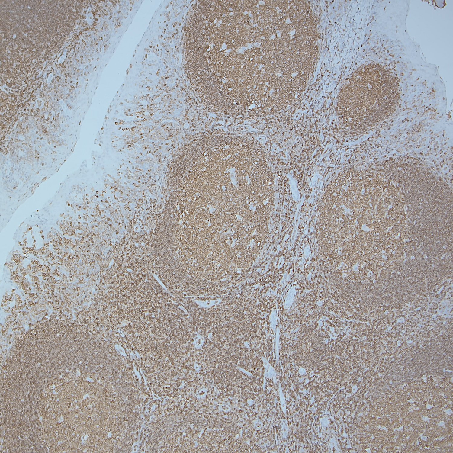 Synaptic Systems - CD45
